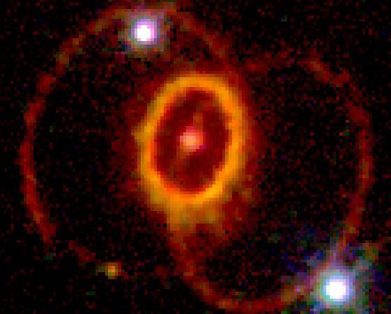 The Mysterious Rings of Supernova 1987A