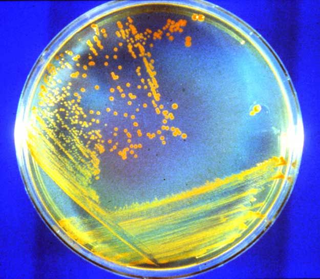 D. rad Bacteria: Candidate Astronauts